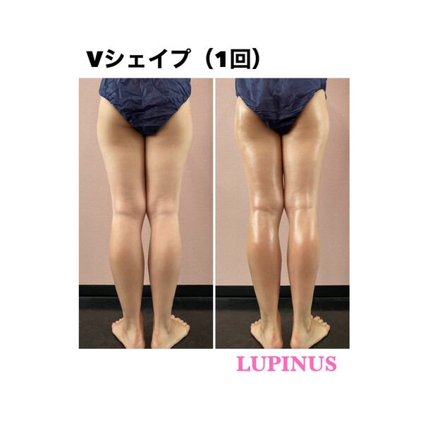 ～美肌・痩身専門店～LUPINUS hisaya | 栄/矢場町のエステサロン