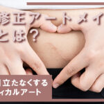 傷跡修正アートメイクの効果とは？肉割れ線・手術跡・傷跡を目立たなくするパラメディカルアート