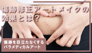 傷跡修正アートメイクの効果とは?肉割れ線・手術跡・傷跡を目立たなくするパラメディカルアート