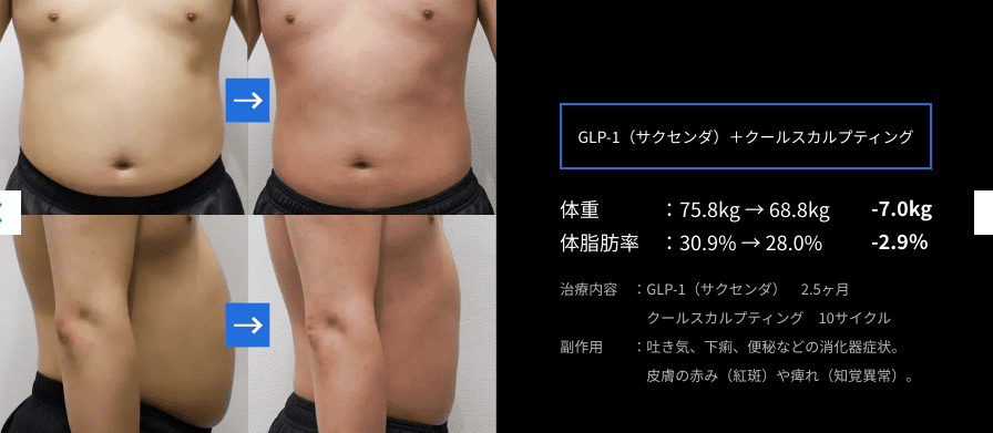 結果はどのくらい持続しますか?