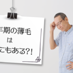 更年期の薄毛は男性にもある？！女性の更年期との違いを解説！