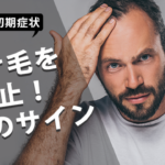 見逃し厳禁！抜け毛を阻止するための「4つの初期症状」とは？