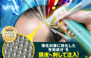 注入型育毛剤 fasa(ファーサ)の口コミ調査!その効果と評判の秘密とは?