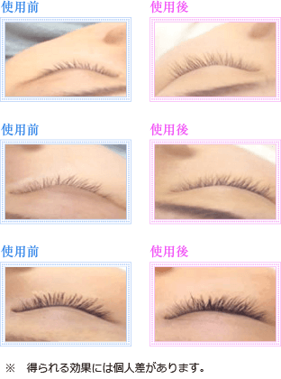 アイエッセンス　使用前　使用後