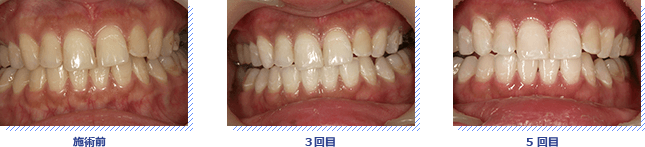 ビフォーアフター写真　こんなに綺麗になった！