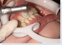 クレンジング中の写真