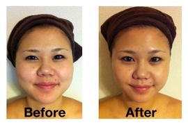 コラーゲンリフトアップコース|エステティックサロン Ｃｕｂｉａ