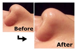 鼻つるりんパック|エステティックサロン Ｃｕｂｉａ