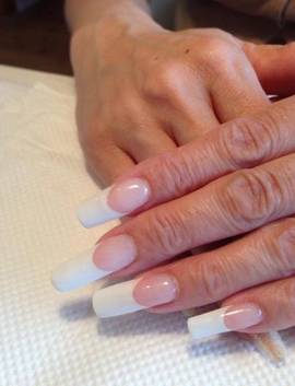 ジェルスカルプ