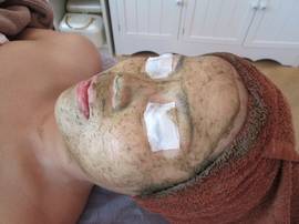 バイオプランタトリートメント