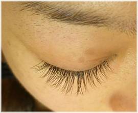 片目に１００本でも０．１ｍｍの太さだけのすごく自然な例|ラマン・ダンジュ