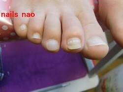 修復後のポリッシュフット