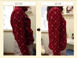 美容整体（産後の整体、骨盤矯正、猫背・姿勢の矯正）|西宮市鳴尾　まつおか鍼灸整体院