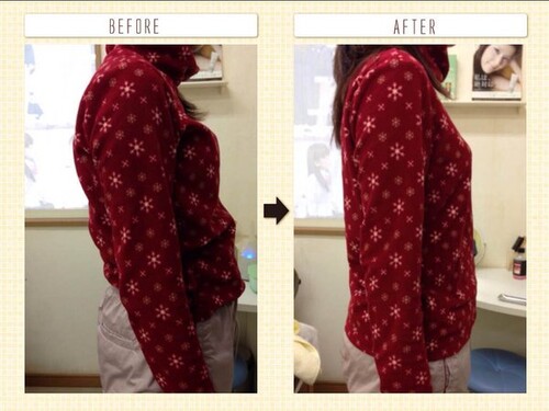 美容整体（産後の整体、骨盤矯正、猫背・姿勢の矯正）