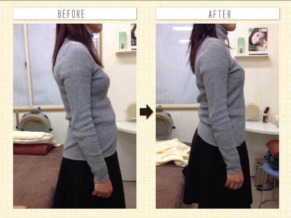 美容整体（産後の整体、骨盤矯正、猫背・姿勢の矯正）|西宮市鳴尾　まつおか鍼灸整体院