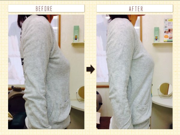 美容整体（産後の整体、骨盤矯正、猫背・姿勢の矯正）|西宮市鳴尾　まつおか鍼灸整体院