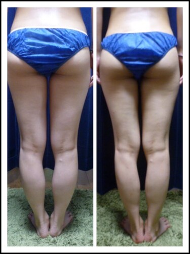 パワーツリー3回