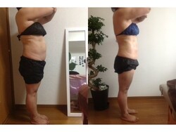 セルライトを減らしたい方