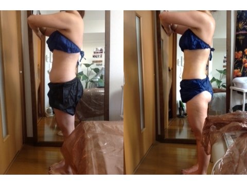 足を痩せたい方|痩身小顔サロン Mix up!! 練馬店