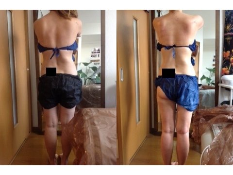 足を痩せたい方|痩身小顔サロン Mix up!! 練馬店