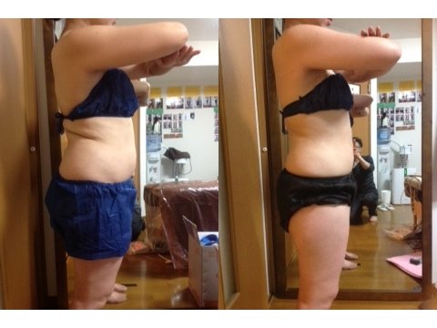 腰とヒップの厚みを減らしたい方|痩身小顔サロン Mix up!! 練馬店