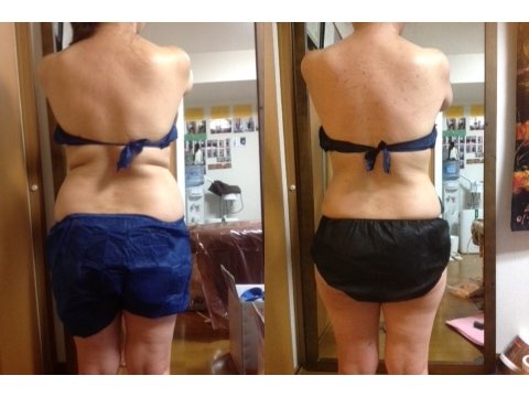 腰とヒップの厚みを減らしたい方|痩身小顔サロン Mix up!! 練馬店