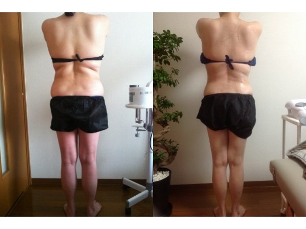 腰とヒップの厚みを減らしたい方|痩身小顔サロン Mix up!! 練馬店