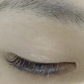 レーザーミンク|BODYQA