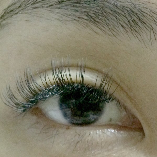 レーザーミンク|BODYQA