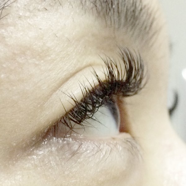 レーザーミンク|BODYQA