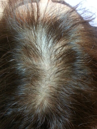 お手軽～レディース増毛４００本