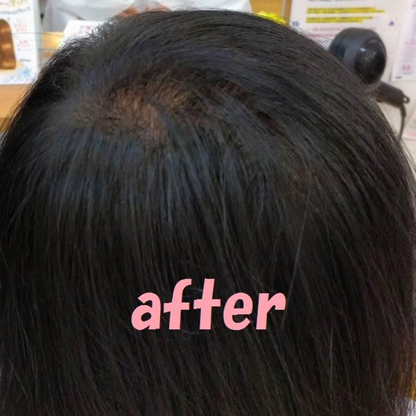 ３D増毛|カットショップ・ハーディーズ