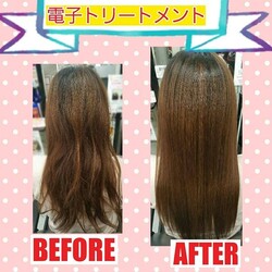 電子トリートメント
