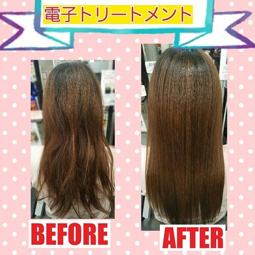 電子トリートメント