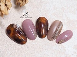 コンサバべっ甲