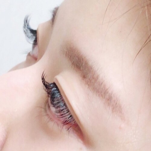 フラットラッシュ