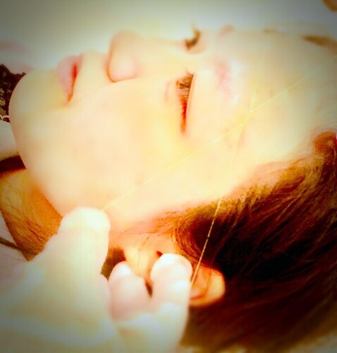 雪美人シルク糸脱毛