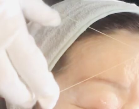 雪美人シルク糸脱毛|エステサロン　Ｔｉａｒａ