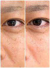 毛穴ディープクレンジング|フェイシャルプライベートサロン-haristeria-