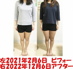 ビフォーアフター|美容矯正専門店 ウェミアス