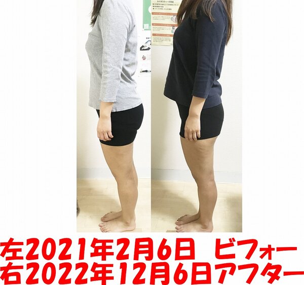 ビフォーアフター|美容矯正専門店 ウェミアス