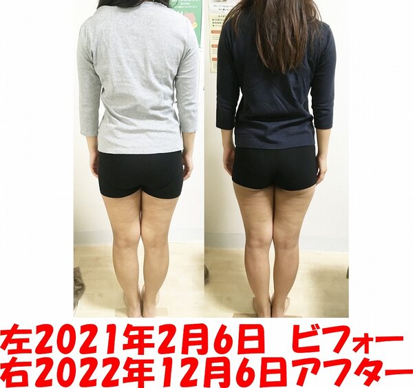 ビフォーアフター|美容矯正専門店 ウェミアス