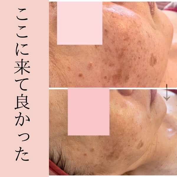 症例写真|美肌専科　心花