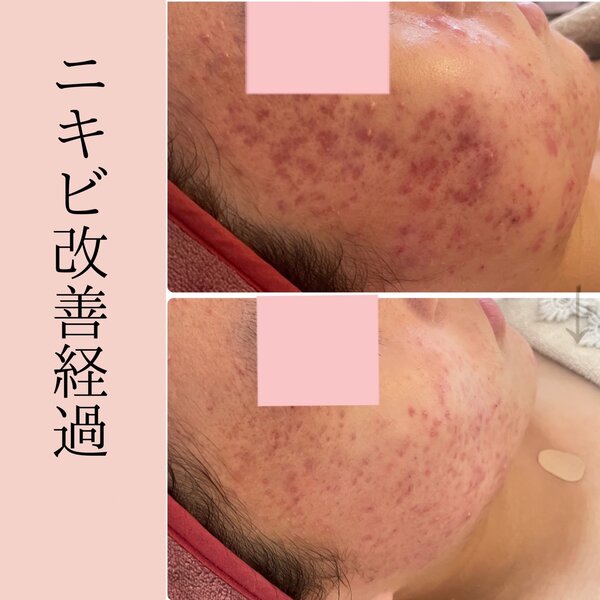 症例写真|美肌専科　心花