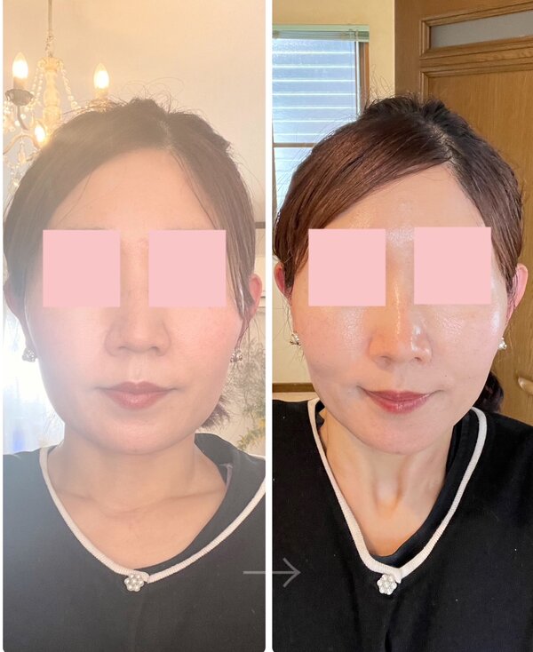 症例写真|美肌専科　心花