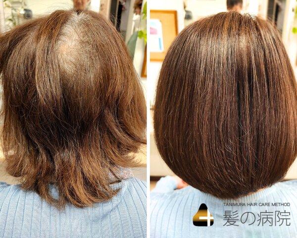 髪の病院Ｋ＆Ｋ美容室　苦楽園店 × 髪質改善・白髪染め｜K＆K　苦楽園店|K＆K　苦楽園店