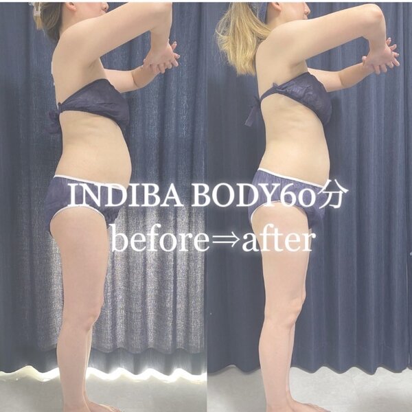 ビフォーアフター①インディバ60分|INDIBA Salon Tres