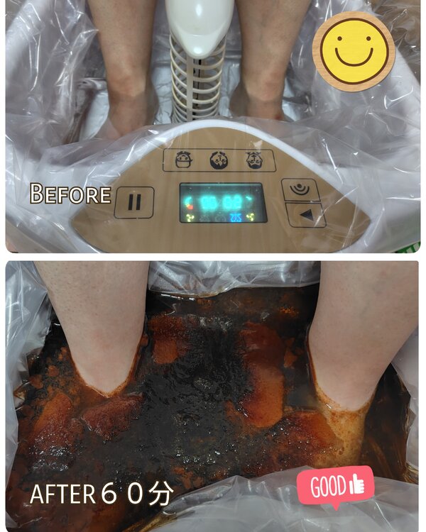 デトックスマシン　ゴッドクリーナー|アフロディーテ　ヒーリング＆デトックス