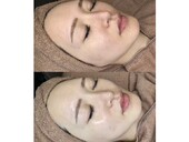 オーダーメイドコース|LUNA skincaresalon