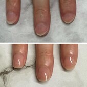 自爪育成★4か月後|Rejuvenail Total Produce